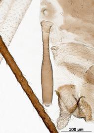 Siphunculus of alata