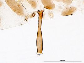 Siphunculus of alata