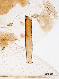 Siphunculus of alata