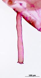 Siphunculus of alata