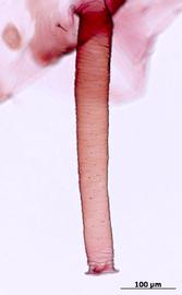 Siphunculus of alata