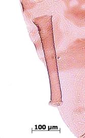 Siphunculus of alata