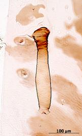 Siphunculus of alata