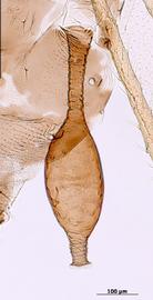 Siphunculus of alata