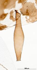 Siphunculus of alata