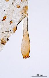 Siphunculus of alata