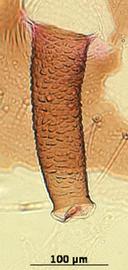 Siphunculus of alata