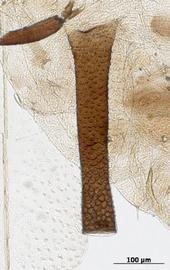 Siphunculus of alata