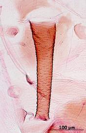 Siphunculus of alata