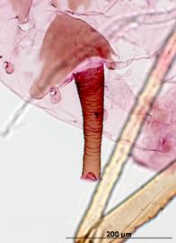 Siphunculus of alata