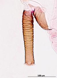 Siphunculus of alata