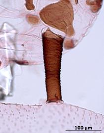 Siphunculus of alata