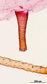 Siphunculus of aptera