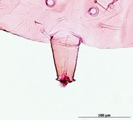 Siphunculus of aptera