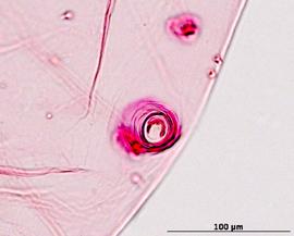 Siphunculus of aptera