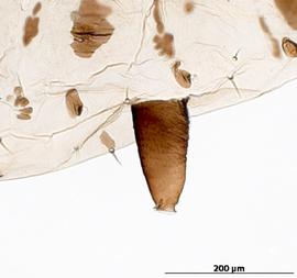 Siphunculus of aptera