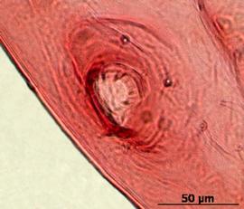 Siphunculus of aptera