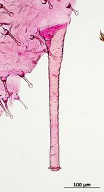 Siphunculus of aptera