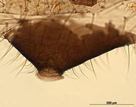 Siphunculus of aptera