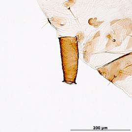 Siphunculus of aptera