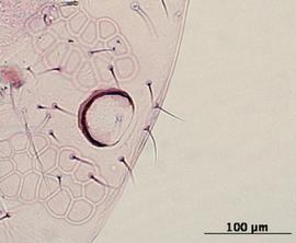 Siphunculus of aptera