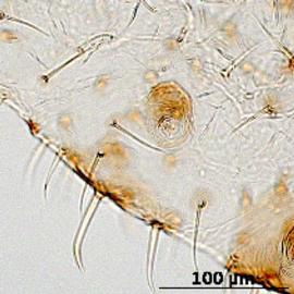 Siphunculus of aptera