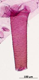 Siphunculus of aptera