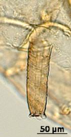 Siphunculus of aptera