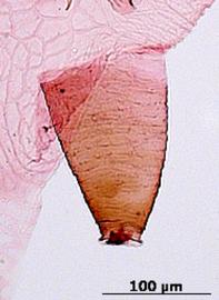 Siphunculus of aptera