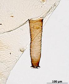 Siphunculus of aptera