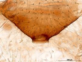 Siphunculus of aptera