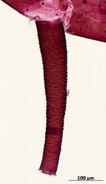 Siphunculus of aptera