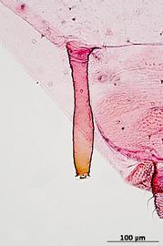 Siphunculus of aptera