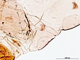 Siphunculus of aptera