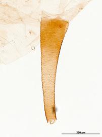 Siphunculus of aptera