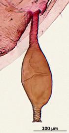 Siphunculus of aptera