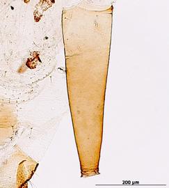 Siphunculus of aptera