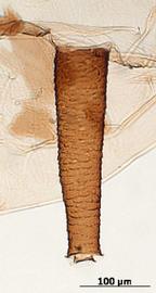 Siphunculus of aptera