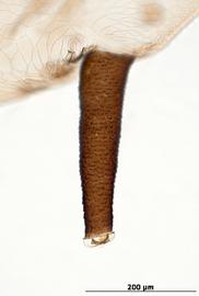 Siphunculus of aptera