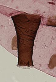 Siphunculus of aptera