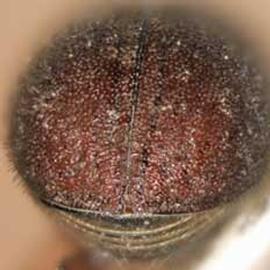   Polygraphus rufipennis  (four-eyed spruce bark beetle), posterior view (declivity) 