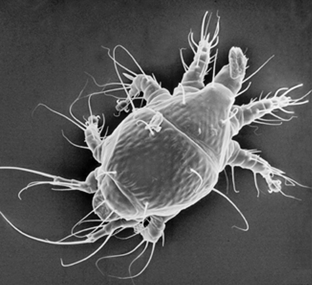 Acarapis, a parasite of bee Apis mellifera; LT-SEM by E. Erbe, mounting by R. Ochoa and J. Pettis, USDA-ARS