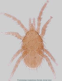  Fig.1.  Proctolaelaps   longisetosus  female, dorsal view. 