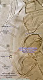  Fig. 10.  Blattisocius dentriticus  female peritreme. 