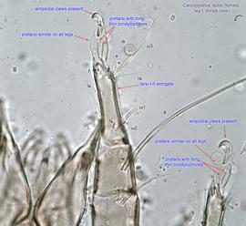  Fig. 11.  Carpoglyphus lactis  female leg I, dorsal  view. 