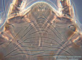  Fig. 11.  Horstia (Horstia) helenae  phoretic deutonymph propodosoma, dorsal view. 