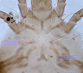  Fig. 11.  Kuzinia laevis  female anterior hysterosoma, dorsal view. 