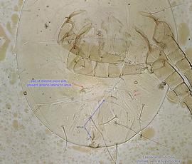  Fig. 11.  Lasioacarus nidicolus  female hysterosoma, ventral view. 