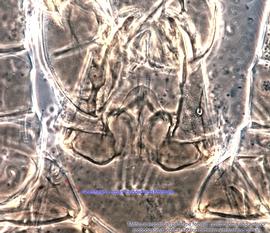  Fig. 12.  Medeus vesparius  paratype female, optical section between ventral and dorsal sides. 