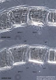  Fig. 13.  Spadiseius spathiphyllae  paratype female genu and tibia I. 